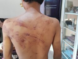 Diduga Dianiaya & Disekap Oknum TNI, Pemuda Asal Palu Laporkan ke Polisi Militer